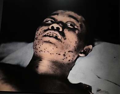 Hibakusha Hibakusha